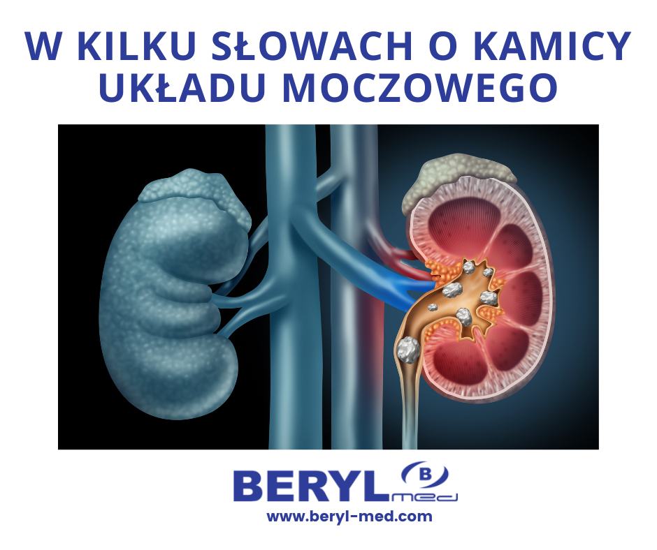 Schemat układu moczowego z widocznymi kamieniami nerkowymi, obrazującymi kamicę układu moczowego